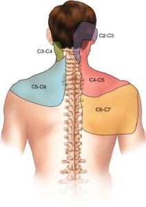 Cervical spine referral patterns