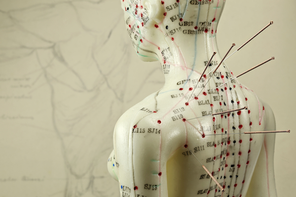 A Guide To Acupuncture | Everything You Need To Know | A Quick Guide